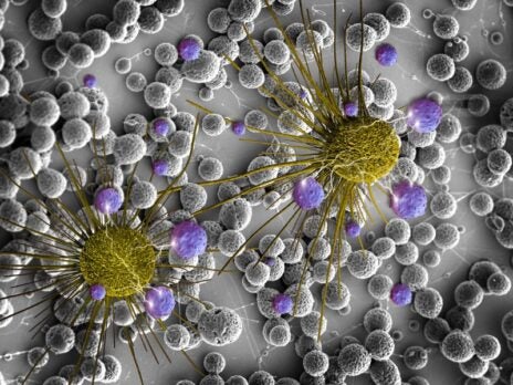 Tocagen’s cancer drug fails to improve survival in glioma trial