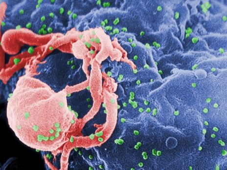 NIAID stops vaccine administration in HIV vaccine clinical trial