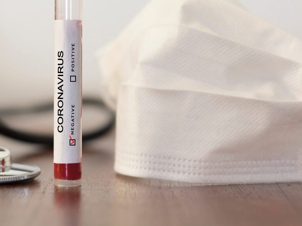Coronavirus test Negative