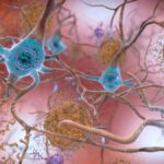 Alzheimer’s trials: Biogen and Lilly’s amyloid-targeting drugs race for FDA approval