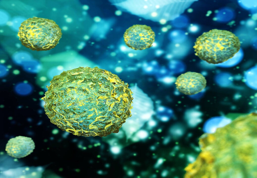 Omeros’ narsoplimab to replace Alexion's Soliris as go-to stem cell-associated TMA therapy