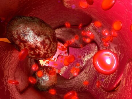 Liquid biopsy tech: non-invasive cancer monitoring in clinical trials
