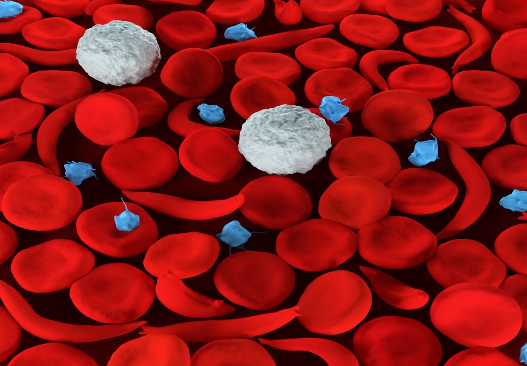 Imara’s IMR-687 for sickle cell disease