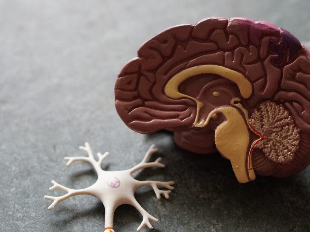 AbbVie s ABBV 951 Meets Primary Goal In Phase III Parkinson s Trial