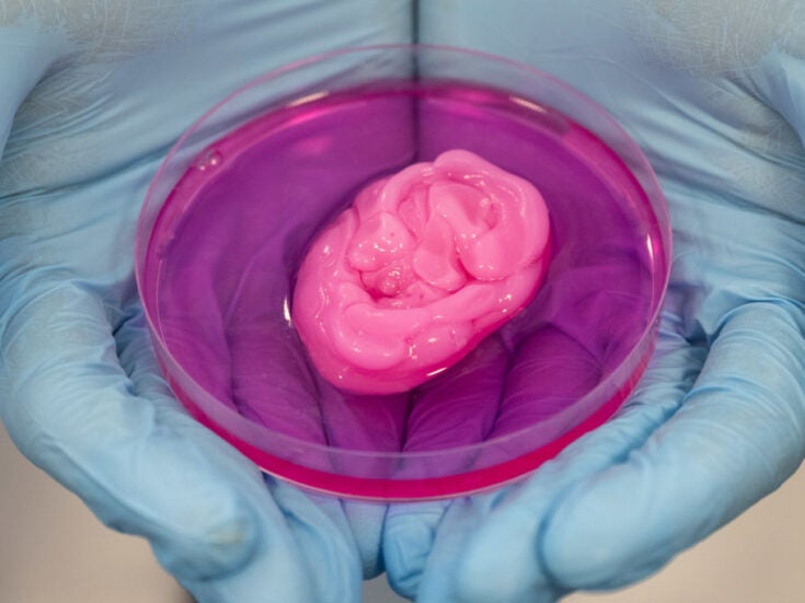 3D printing: What is the executive and medical view on the tech in healthcare?