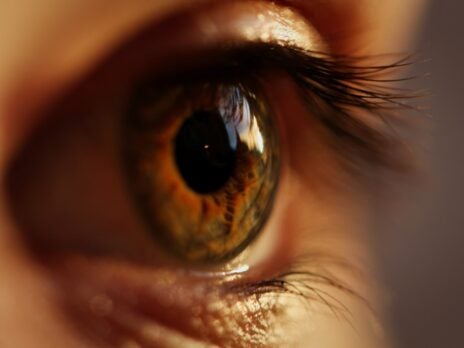 Ocuphire initiates enrolment in trial of Nyxol to reverse mydriasis  