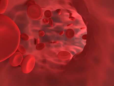 Imara updates primary goal of Phase IIb sickle cell disease therapy trial