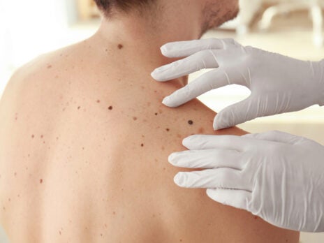 Africa has seen the largest growth in dermatology-related trials over the past decade