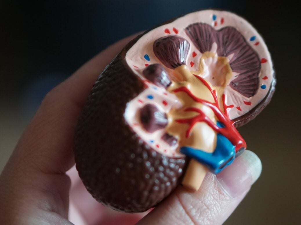 Arrowhead starts trial of complement-mediated disease therapeutic - Vimarsana News