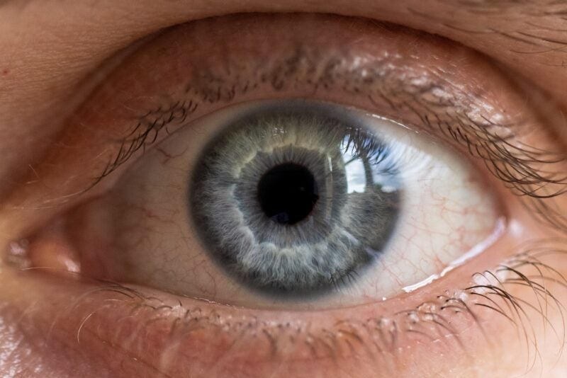 VivaVision reports positive data from Phase II dry eye disease trial - Vimarsana News