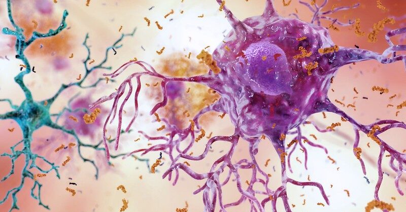 Sage reports positive data from Phase II Alzheimer's disease drug trial - Vimarsana News