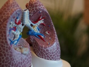 Boehringer’s IPF therapy slows lung function decline in Phase II trial