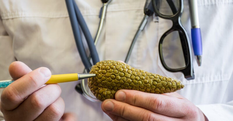 Corcept terminates Phase III pancreatic ductal adenocarcinoma trial - Vimarsana News
