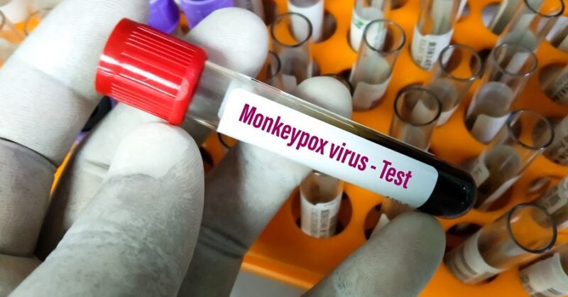 Could monkeypox become established outside of Africa? - Vimarsana News