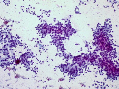 BeiGene reports Phase III tislelizumab data in hepatocellular cancer