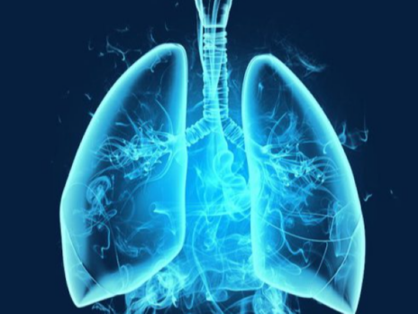 Genprex to progress Phase I/II trial of non-small cell lung cancer therapy