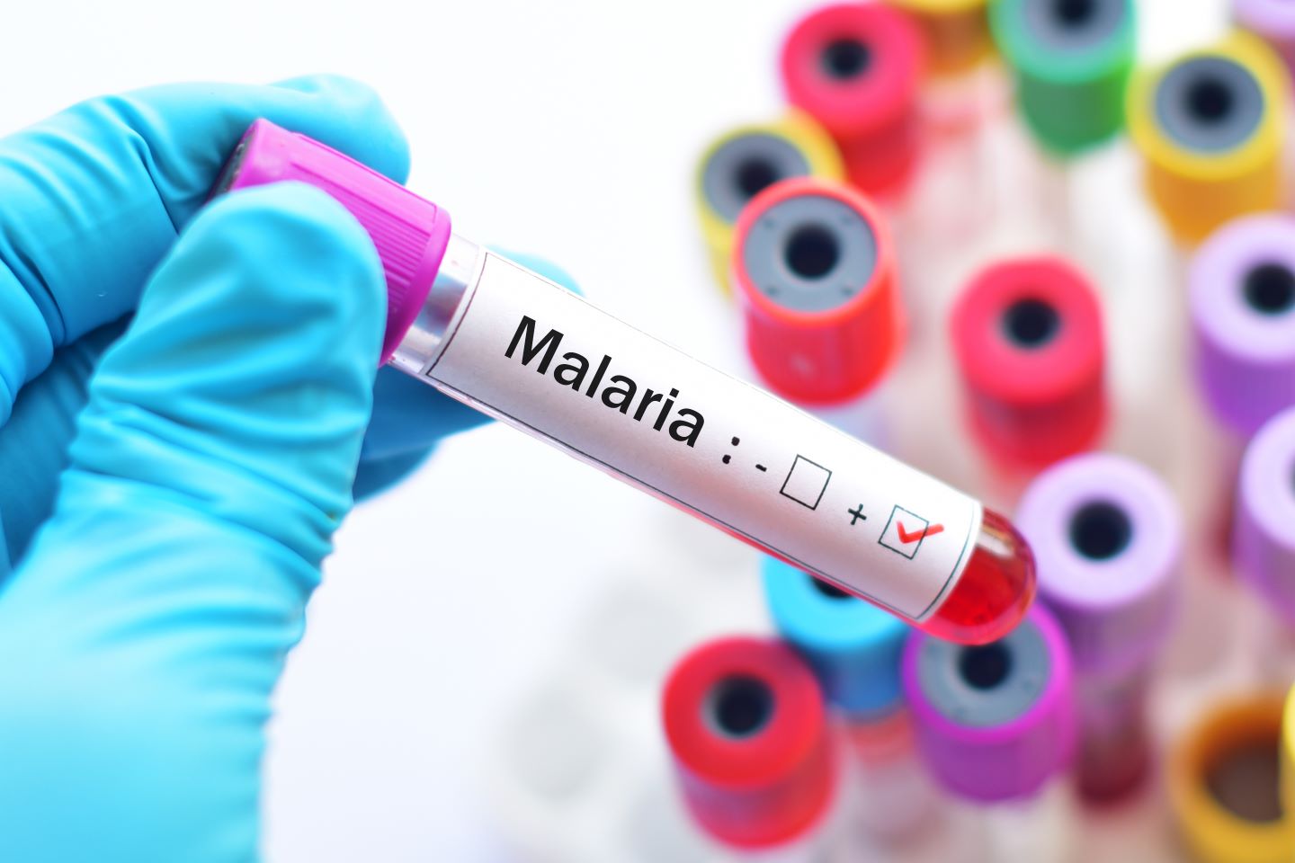 Se han confirmado casos domésticos de malaria en los Estados Unidos.