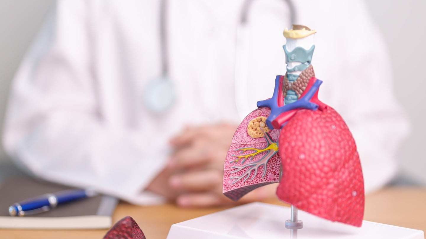 ReCode initiates Phase II trial of RCT2100 with ivacaftor for CF