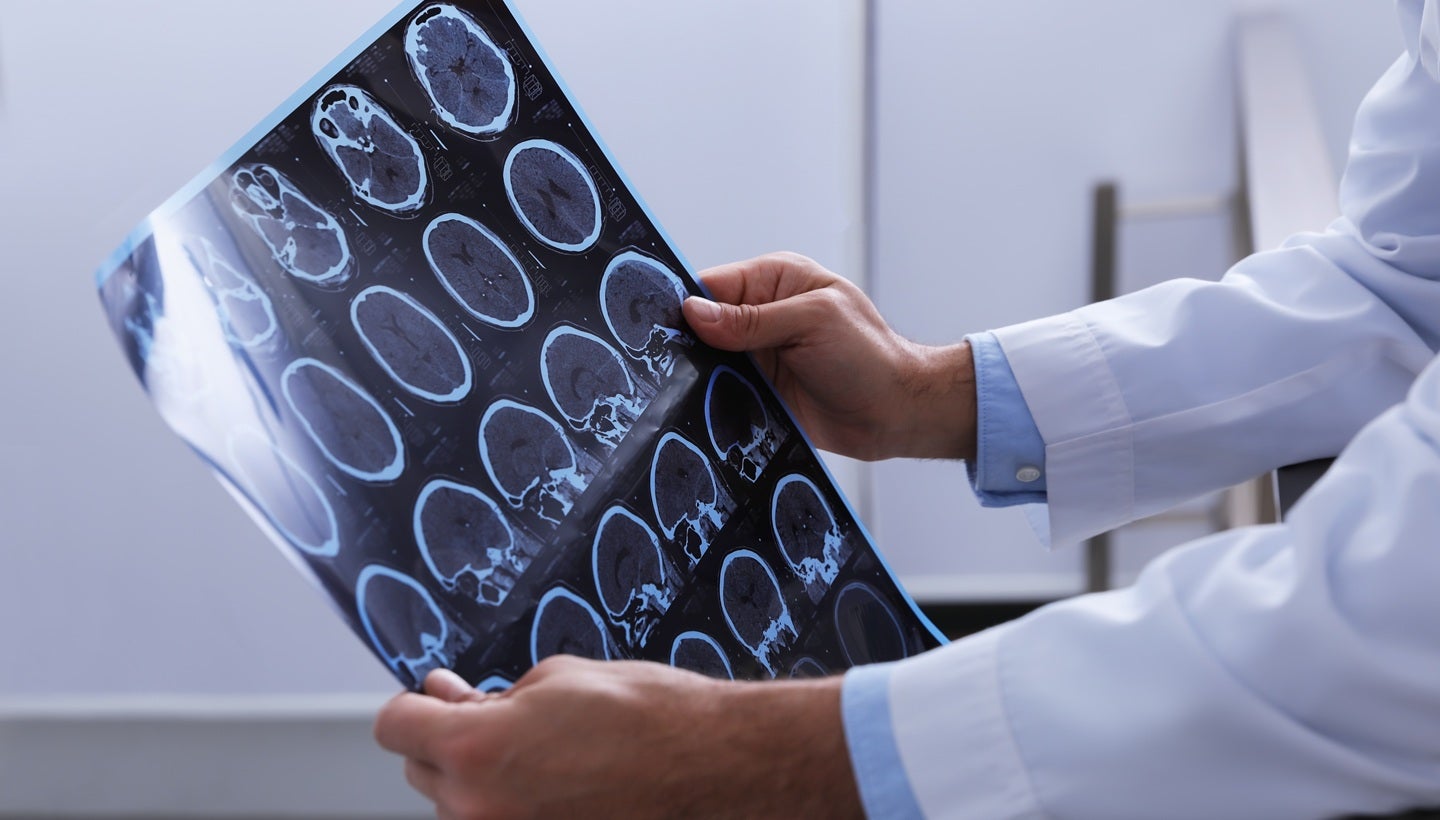 SEQSTER and Praxis expand collaboration to expedite CNS disorder trials