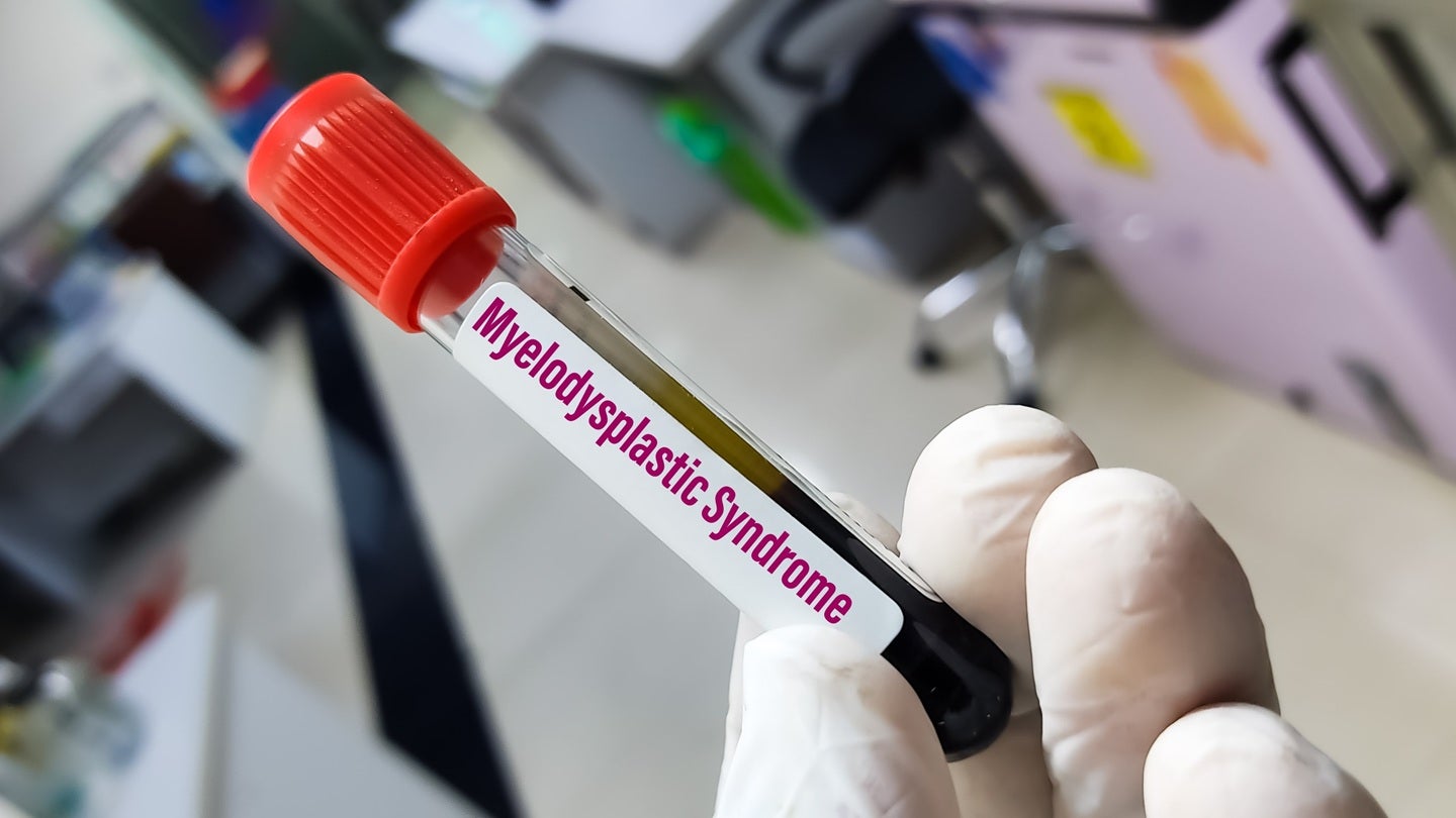 Faron and City of Hope to develop Phase II trial of bexmarilimab for r/r MDS