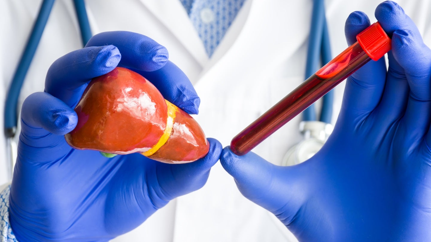 Rivus Pharmaceuticals begins patient dosing in Phase II AMPLIFY trial