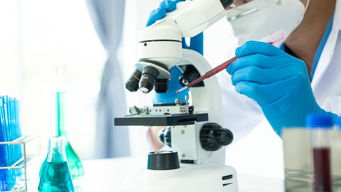 Patient enrolment concludes in Alebund’s Phase III trial of AP301