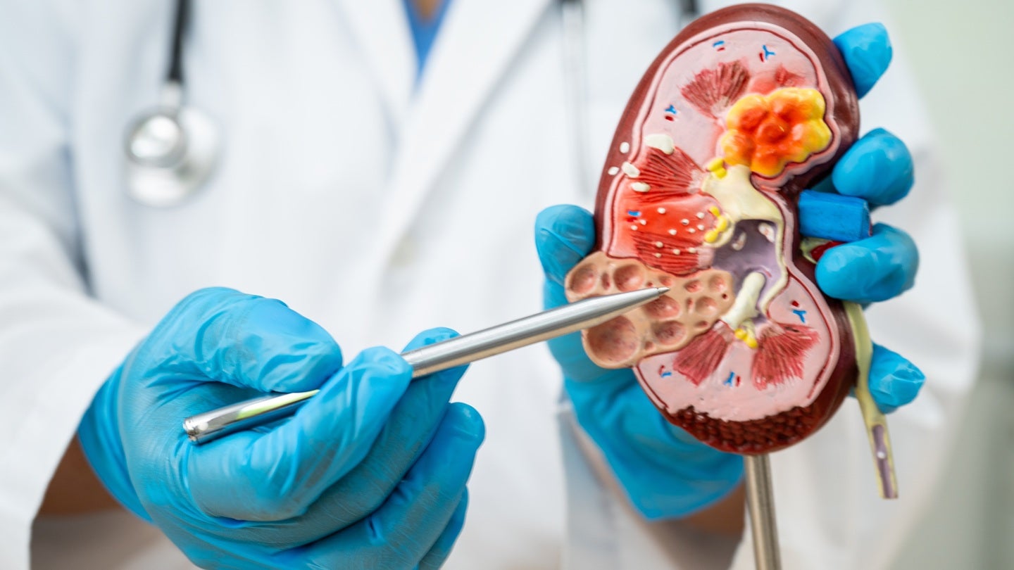 First participant dosed in Jade’s Phase II JUNIPER trial for IgAN