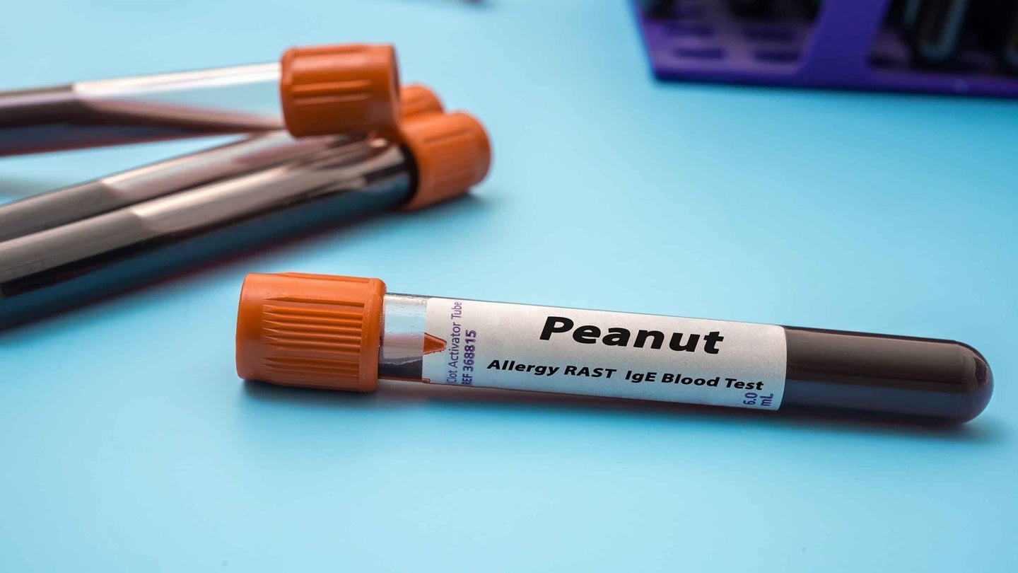 Moonlight begins SURVEYOR Phase I trial for peanut allergy