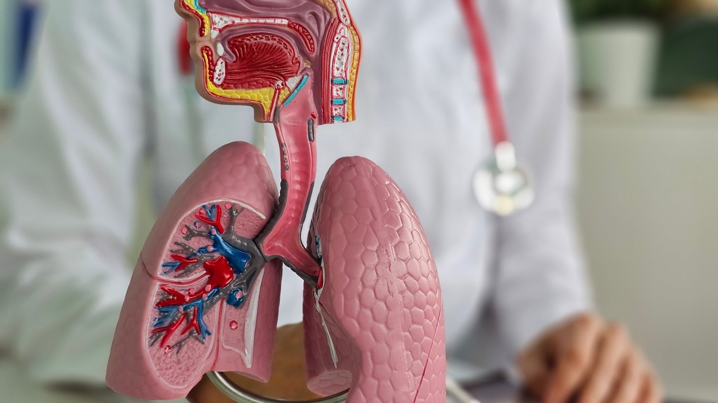 ESMO26: Sac-TMT’s OptiTROP-Lung04 survival gain holds, putting the onus on MSD