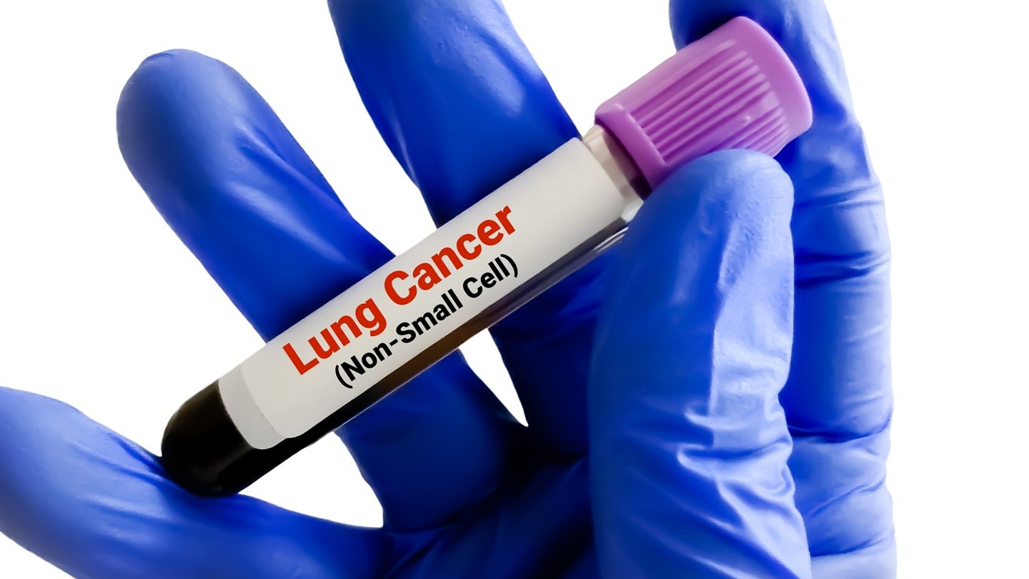 MAIA Biotechnology opens second US site for THIO-101 trial