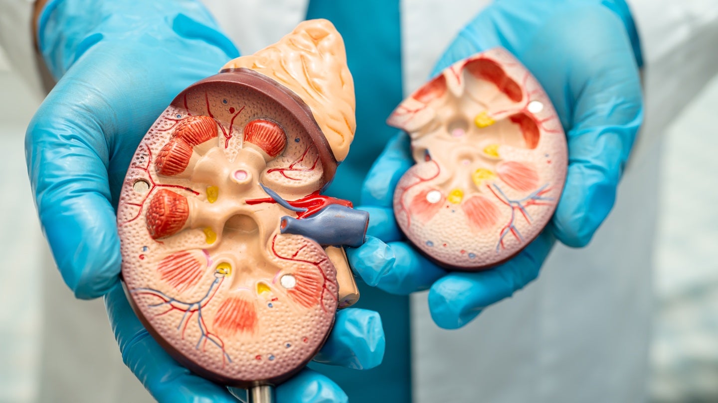 Viatris reports positive topline data from trial of VR-205 for IgAN
