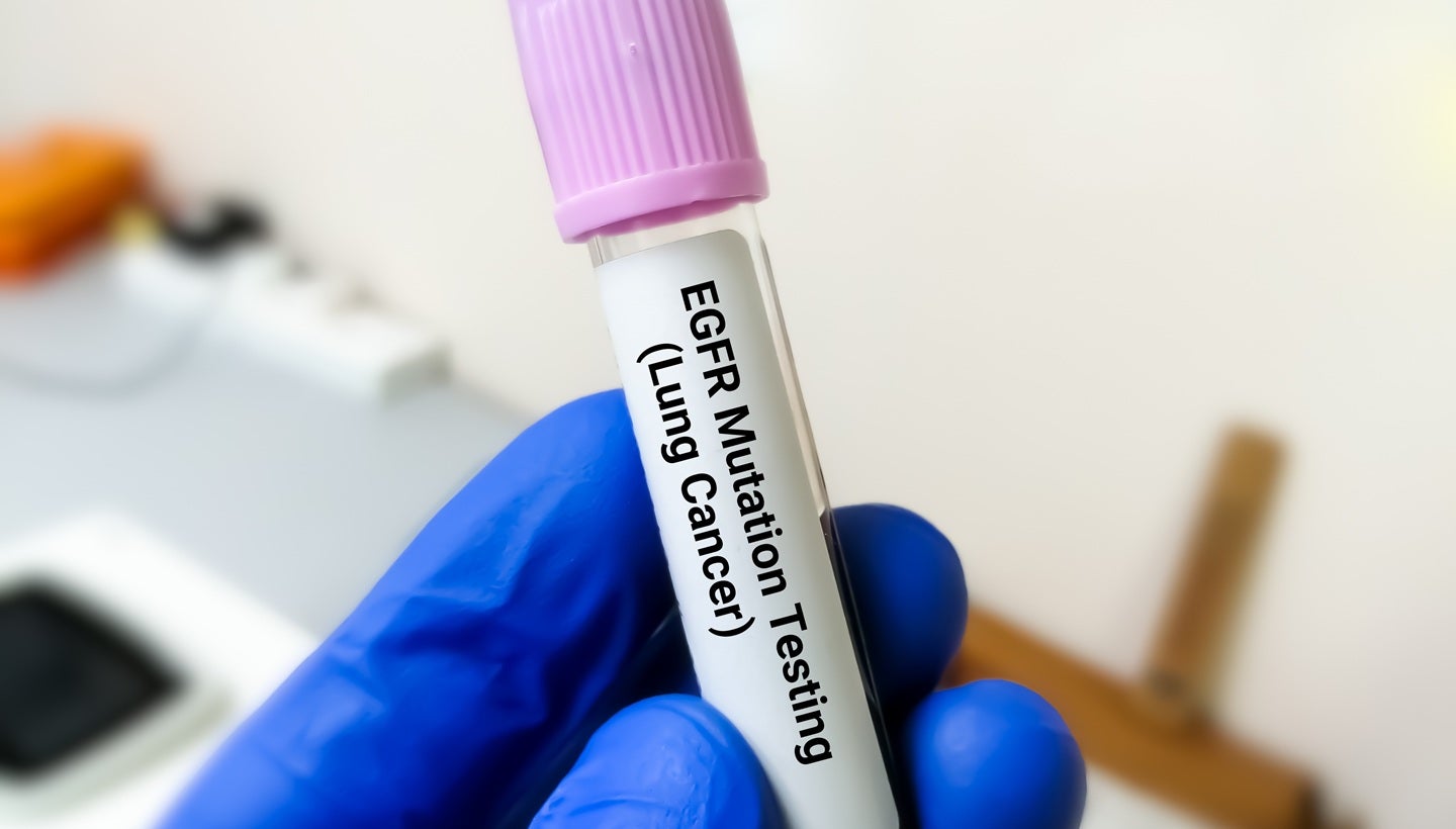 First patient dosed in Racura’s HARNESS-1 trial of RC220 