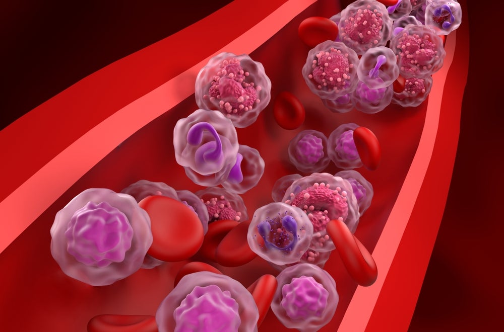 ASCO26: BMS and J&J debut shining multiple myeloma data