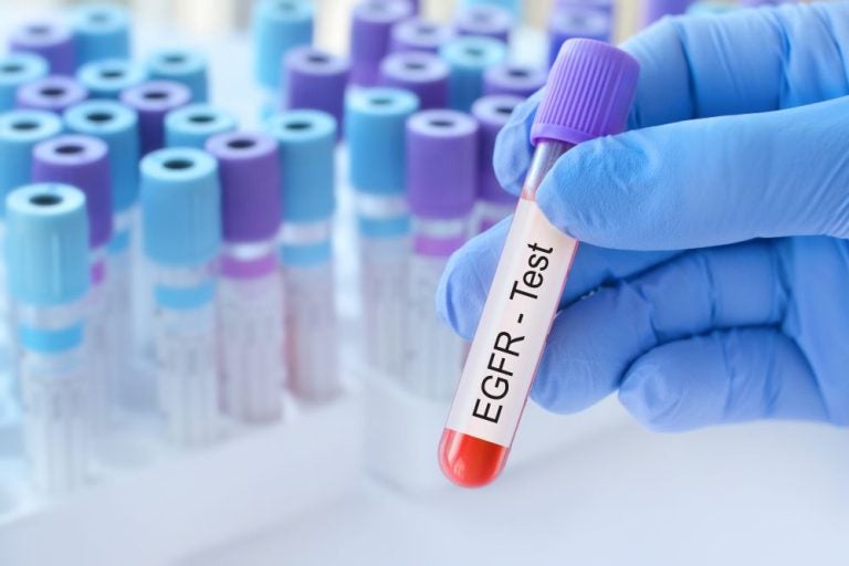 Early Biomarkers as Predictors of Nephrology Trial Trajectory