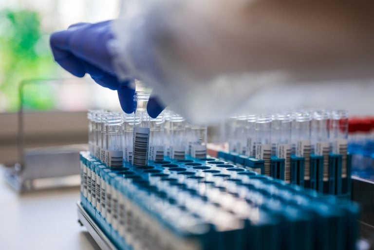 How gene therapies are changing the Qualified Person role in the EU