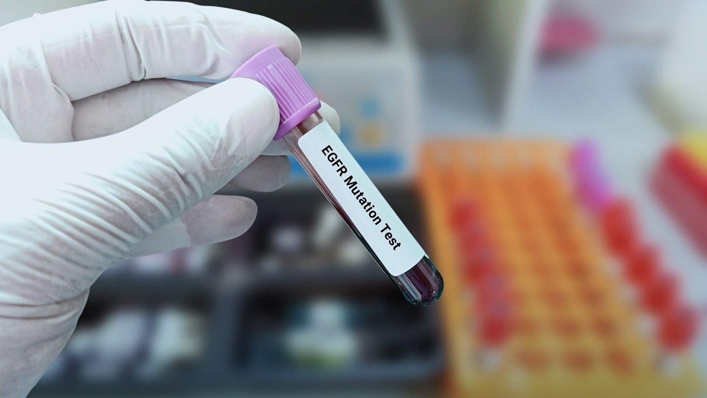 AstraZeneca and Abbisko collaborate on NSCLC combination therapy trial