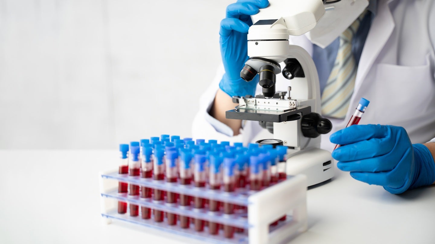 Verrica completes enrolment in Phase III trial of Ycanth