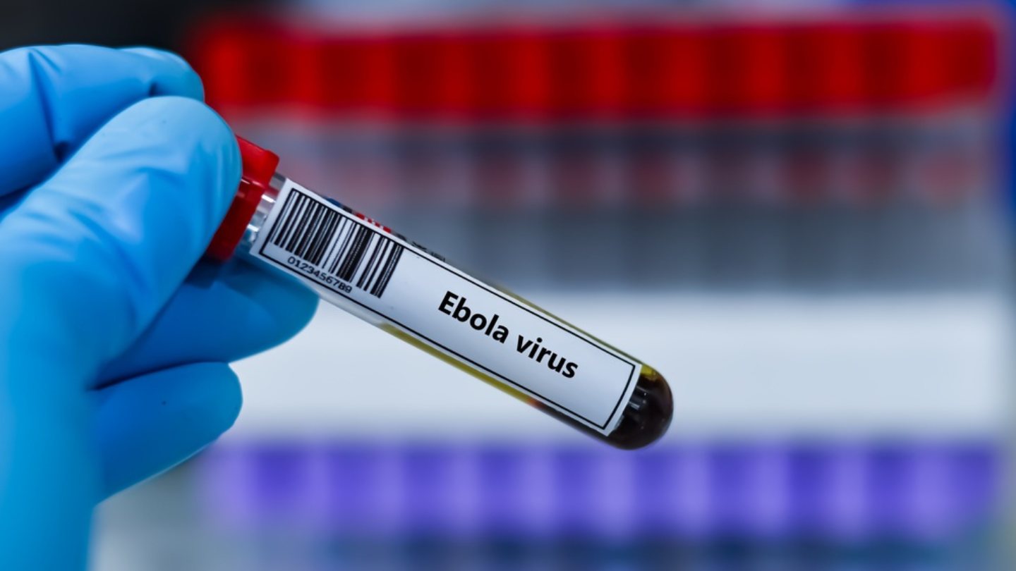 Moderna kicks off Phase I Ebola trial as Africa readies itself for research
