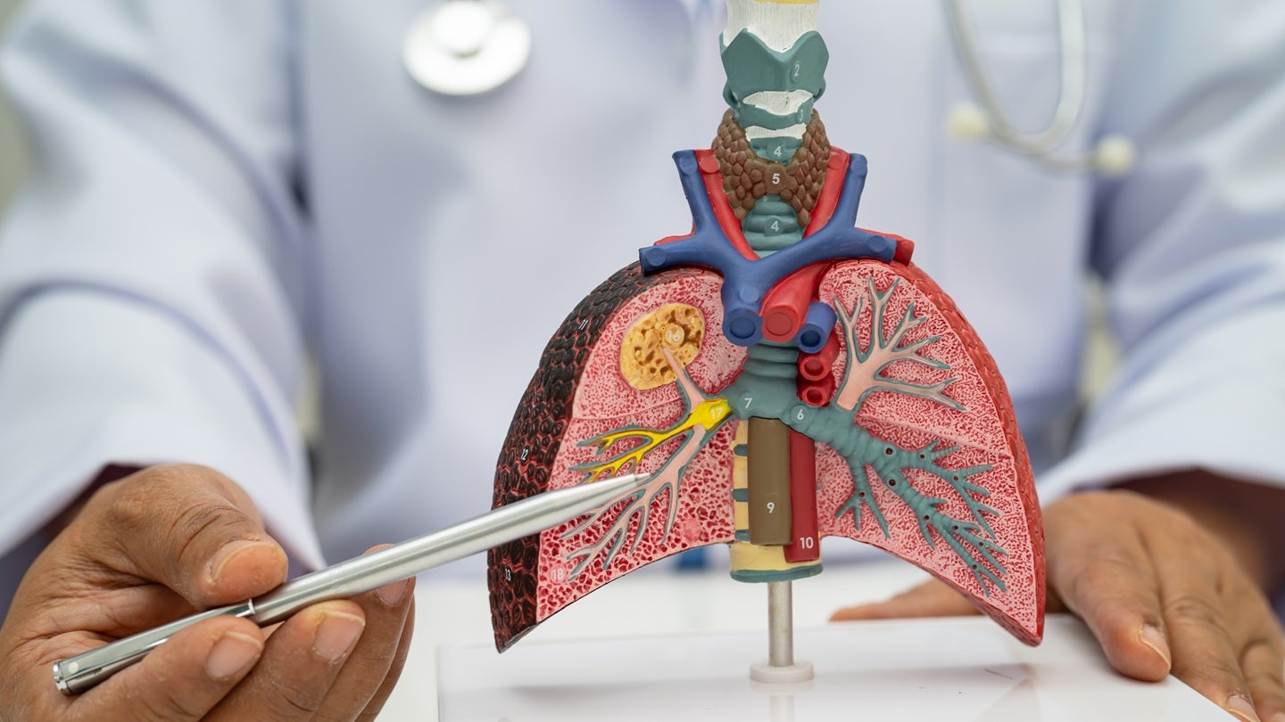 Rezubio doses first cohort in Phase I trial of inhaled RZ-520