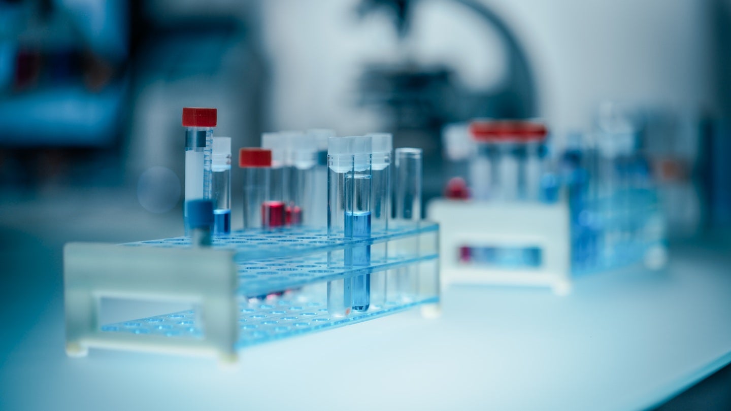 SpliSense begins Phase IIb SPL84 trial for cystic fibrosis