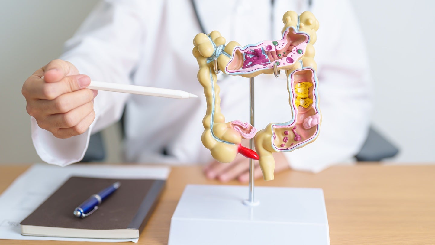 First patient dosed in Accro Bioscience’s Phase IIb AC-101 study