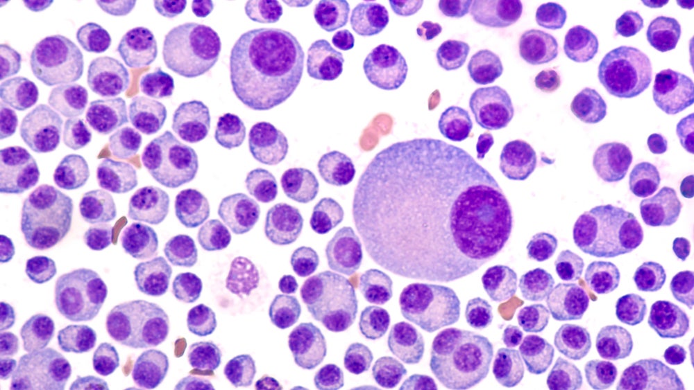 IMS26: Key readouts rock the multiple myeloma field amid shifting landscape 