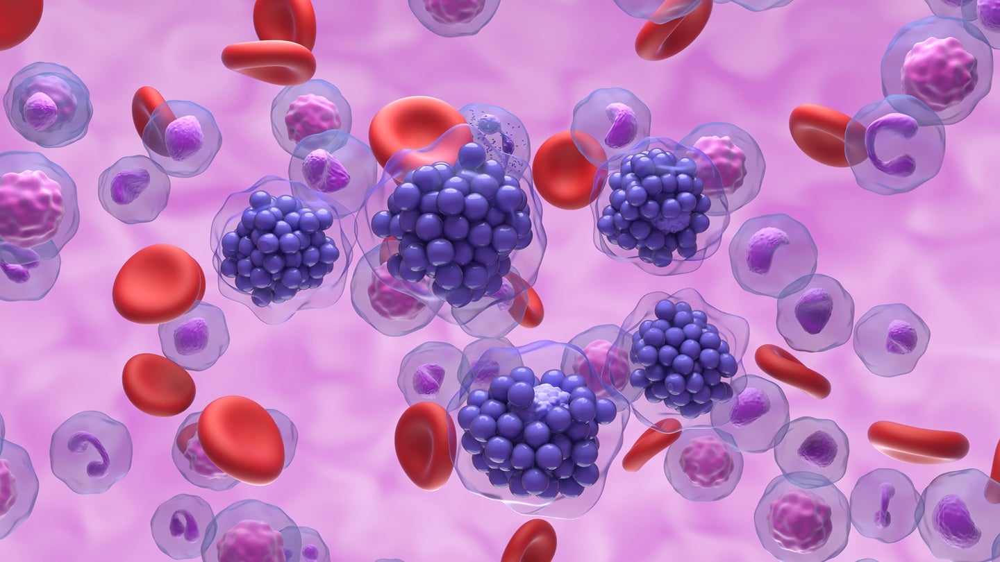 AbbVie, Genmab report positive results from Phase III EPCORE DLBCL-2 trial