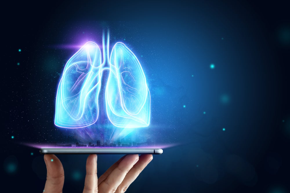 Brainomix’s e-Lung shows progression and treatment response in Phase III trial